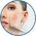 Skin Treatments at Allure Aesthetics Clinic, Pune